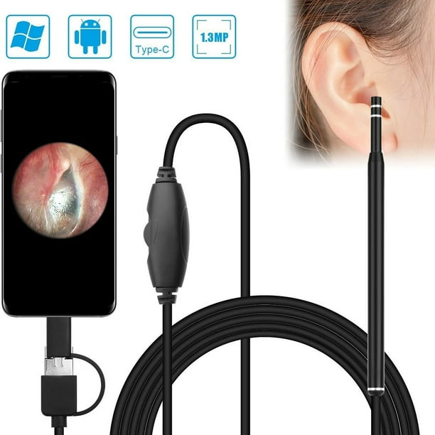 3-in-1 HD Visual Ear Pick Ear Canal Endoscope Oral Endoscope with LED Light Black, OneSize 